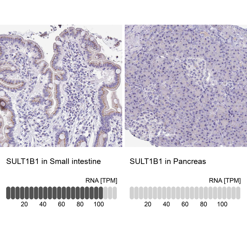 Anti-SULT1B1 Antibody