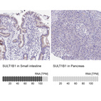 Anti-SULT1B1 Antibody