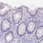 Anti-SULT1B1 Antibody