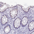 Immunohistochemical staining of human colon shows weak granular positivity in cytoplasm in glandular cells.