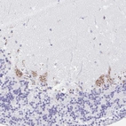 Immunohistochemical staining of human cerebellum shows moderate positivity in cytoplasm granular in Purkinje cells.