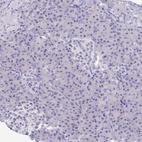 Immunohistochemical staining of human pancreas shows no positivity in exocrine glandular cells as expected.