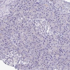 Immunohistochemical staining of human pancreas shows no positivity in exocrine glandular cells as expected.