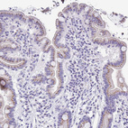 Anti-SULT1B1 Antibody