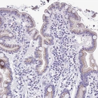 Immunohistochemical staining of human small intestine shows moderate granular positivity in cytoplasm in glandular cells.