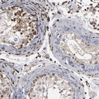 Anti-KIAA2026 Antibody