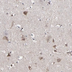 Immunohistochemical staining of human cerebral cortex shows moderate cytoplasmic-membranous positivity in neurons.