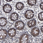 Immunohistochemical staining of human colon shows moderate cytoplasmic positivity in glandular cells.