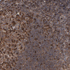 Anti-KIAA2026 Antibody