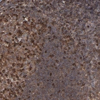 Immunohistochemical staining of human tonsil shows strong cytoplasmic-membranous positivity in germinal center cells and non-germinal center cells.