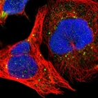 Immunofluorescent staining of human cell line A-431 shows localization to cytosol & vesicles.