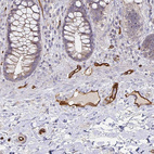 Anti-PODXL Antibody