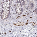 Immunohistochemical staining of human rectum shows strong membranous positivity in endothelial cells.