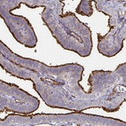 Immunohistochemical staining of human fallopian tube shows strong positivity in cilia in glandular cells.
