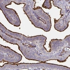 Immunohistochemical staining of human fallopian tube shows strong positivity in cilia in glandular cells.