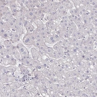 Immunohistochemical staining of human liver shows no positivity in hepatocytes as expected.