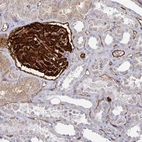 Immunohistochemical staining of human kidney shows strong membranous positivity in cells in glomeruli.
