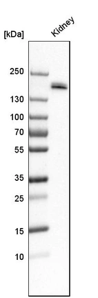 Western blot analysis in human kidney tissue.