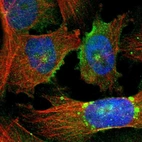 Immunofluorescent staining of human cell line U-251 MG shows localization to nucleoli, plasma membrane, microtubule organizing center & vesicles.