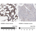 Anti-KDM6A Antibody