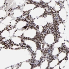 Immunohistochemical staining of human bone marrow shows strong nuclear positivity in hematopoietic cells.