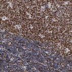 Immunohistochemical staining of human lymph node shows moderate to strong nuclear positivity in germinal center cells.