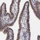 Anti-KDM6A Antibody