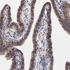 Immunohistochemical staining of human Fallopian tube shows moderate nuclear positivity in glandular cells.