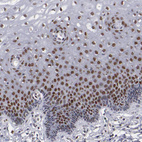 Immunohistochemical staining of human cervix shows moderate to strong nuclear positivity in squamous epithelial cells.