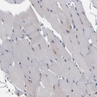 Immunohistochemical staining of human skeletal muscle shows no positivity in myocytes as expected.