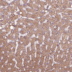 Anti-HYAL1 Antibody