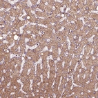 Immunohistochemical staining of human liver shows moderate to strong granular cytoplasmic positivity in hepatocytes.