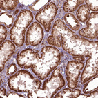 Anti-HYAL1 Antibody