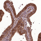 Anti-HYAL1 Antibody