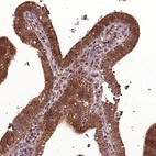 Immunohistochemical staining of human gallbladder shows moderate to strong granular cytoplasmic positivity in glandular cells.