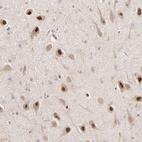 Anti-PSMD14 Antibody