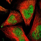 Immunofluorescent staining of human cell line U-2 OS shows localization to nucleoplasm & vesicles.