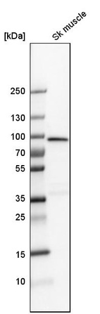 Western blot analysis in human skeletal muscle tissue.