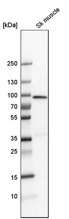 Western blot analysis in human skeletal muscle tissue.