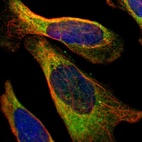Immunofluorescent staining of human cell line U-2 OS shows localization to endoplasmic reticulum.