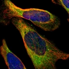 Immunofluorescent staining of human cell line U-2 OS shows localization to endoplasmic reticulum.