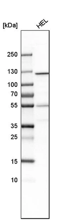Western blot analysis in human cell line HEL.