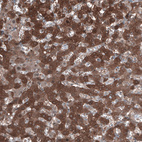 Anti-ALDH1A1 Antibody