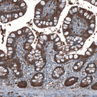 Anti-ALDH1A1 Antibody