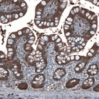 Immunohistochemical staining of human small intestine shows moderate cytoplasmic positivity in glandular cells.