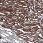 Immunohistochemical staining of human kidney shows strong cytoplasmic positivity in cells in tubules.