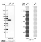 Western blot analysis in human cell lines A-549 and A-431 using Anti-ALDH1A1 antibody. Corresponding ALDH1A1 RNA-seq data are presented for the same cell lines. Loading control: Anti-PPIB.