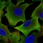 Immunofluorescent staining of human cell line A549 shows localization to cytosol.