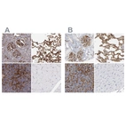 Immunohistochemical staining of human kidney, lung, lymph node and skeletal muscle using Anti-ICAM1 antibody HPA002126 (A) shows similar protein distribution across tissues to independent antibody HPA004877 (B).