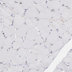 Immunohistochemical staining of human skeletal muscle shows no positivity in cells in glomeruli.